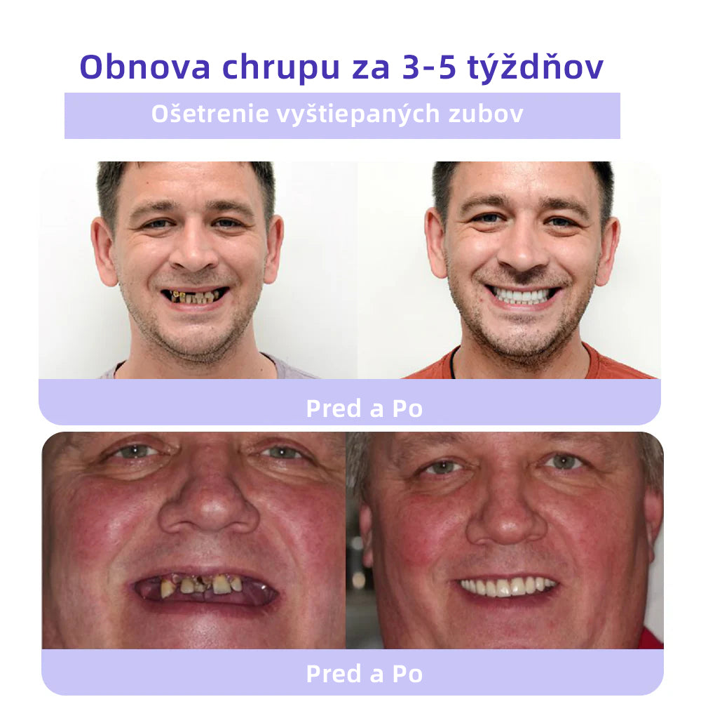 𝑂𝑦𝑖𝑘𝑒𝑦™🦷 𝑜𝑏𝑛𝑜𝑣𝑢 𝑧𝑢𝑏𝑜𝑣 𝑀𝑖𝑛𝑒𝑟á𝑙𝑛𝑦 𝑝𝑟áš𝑜𝑘 (𝑜𝑑𝑝𝑜𝑟úč𝑎𝑛é 𝑆𝐾𝑍𝐿) 👨⚕️