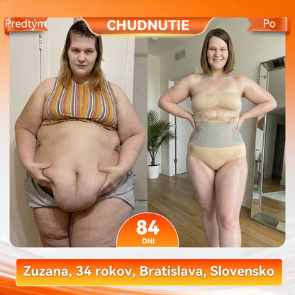 Oficiálny obchod značky |🩳𝑷𝑨𝑼𝑹𝑨𝑱𝑼®  MORINGA & BERBERÍN 4V 1 MIKROČASTICOVÉ FORMOVANIE & ŠORTKY NA SPALOVANIE TUKU💪