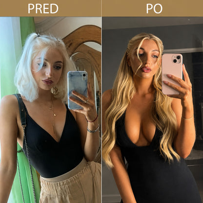 Turonu®👩‍⚕️ Cielená pokročilá nano-mikroihličková náplasť na zväčšenie poprsia🍁