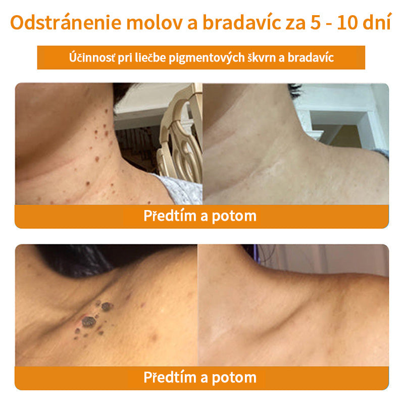 𝑇𝑢𝑟𝑜𝑛𝑢™ Krém na ošetrenie pleti s včelím jedom（SAV Odporúčané）💎