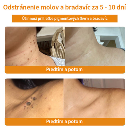 𝑇𝑢𝑟𝑜𝑛𝑢™ Krém na ošetrenie pleti s včelím jedom（SAV Odporúčané）💎