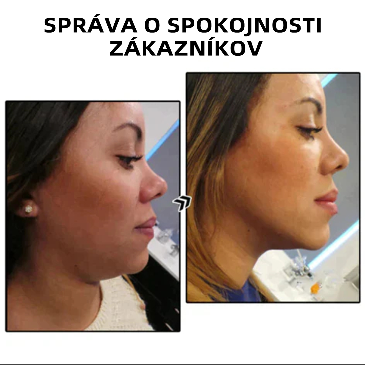 CZTICLE™ Náušnice na podporu lymfatickej aktivity🔥 (Časovo obmedzená ponuka 🎄 Vianočná akcia)