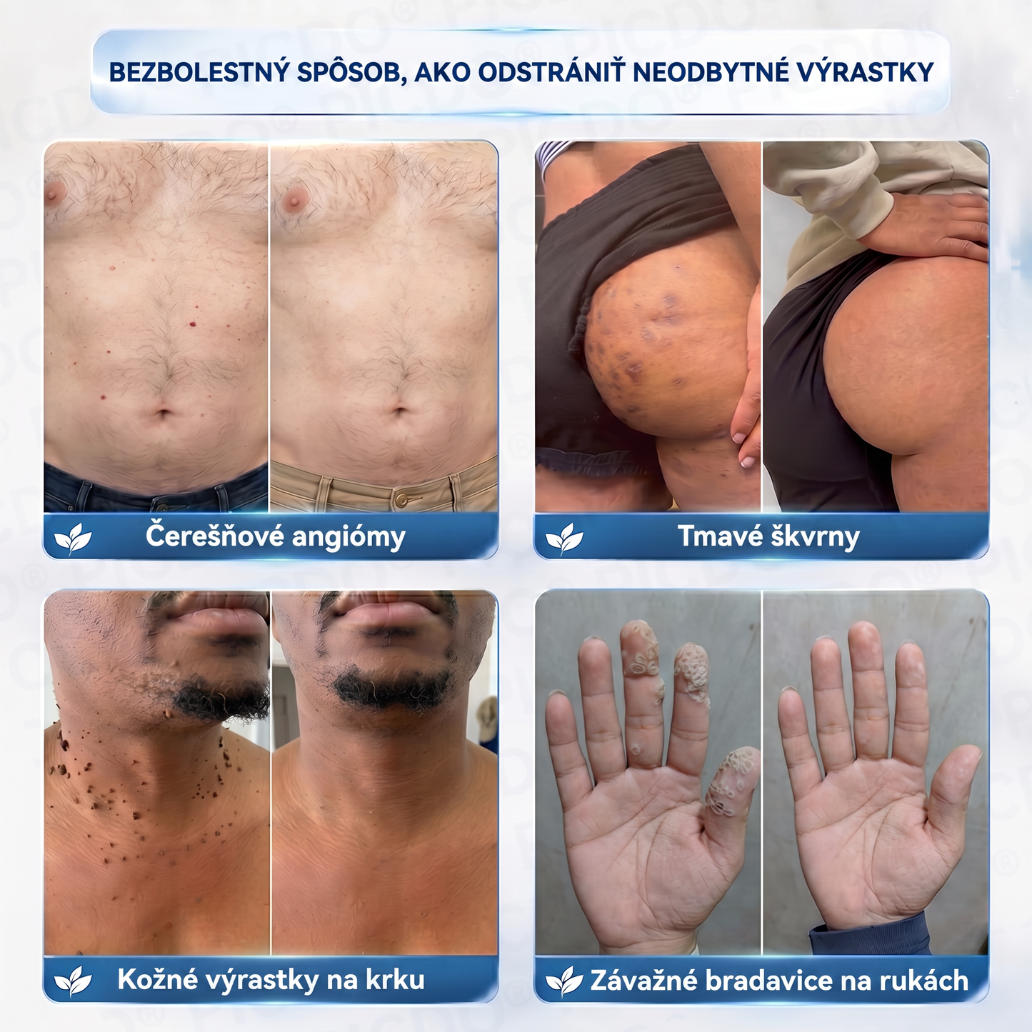 𝐏𝐢𝐜𝐝𝐨® 𝟕-𝐝𝐧̌𝐨𝐯ý 𝐤𝐫é𝐦 𝐩𝐫𝐞 𝐯𝐢𝐬𝐧𝐮𝐭ú 𝐩𝐨𝐤𝐨ž𝐤𝐮 𝐚 𝐩𝐢𝐠𝐦𝐞𝐧𝐭𝐨𝐯é 𝐟𝐥𝐞𝐤𝐲 (𝐛𝐞𝐳𝐛𝐨𝐥𝐞𝐬𝐭𝐧á 𝐟𝐨𝐫𝐦𝐮𝐥𝐚 – 𝐛𝐞𝐳 𝐣𝐚𝐳𝐯𝐢𝐞𝐯) 🍁