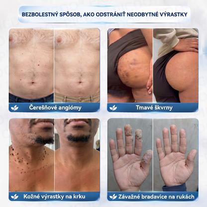 𝐏𝐢𝐜𝐝𝐨® 𝟕-𝐝𝐧̌𝐨𝐯ý 𝐤𝐫é𝐦 𝐩𝐫𝐞 𝐯𝐢𝐬𝐧𝐮𝐭ú 𝐩𝐨𝐤𝐨ž𝐤𝐮 𝐚 𝐩𝐢𝐠𝐦𝐞𝐧𝐭𝐨𝐯é 𝐟𝐥𝐞𝐤𝐲 (𝐛𝐞𝐳𝐛𝐨𝐥𝐞𝐬𝐭𝐧á 𝐟𝐨𝐫𝐦𝐮𝐥𝐚 – 𝐛𝐞𝐳 𝐣𝐚𝐳𝐯𝐢𝐞𝐯) 🍁