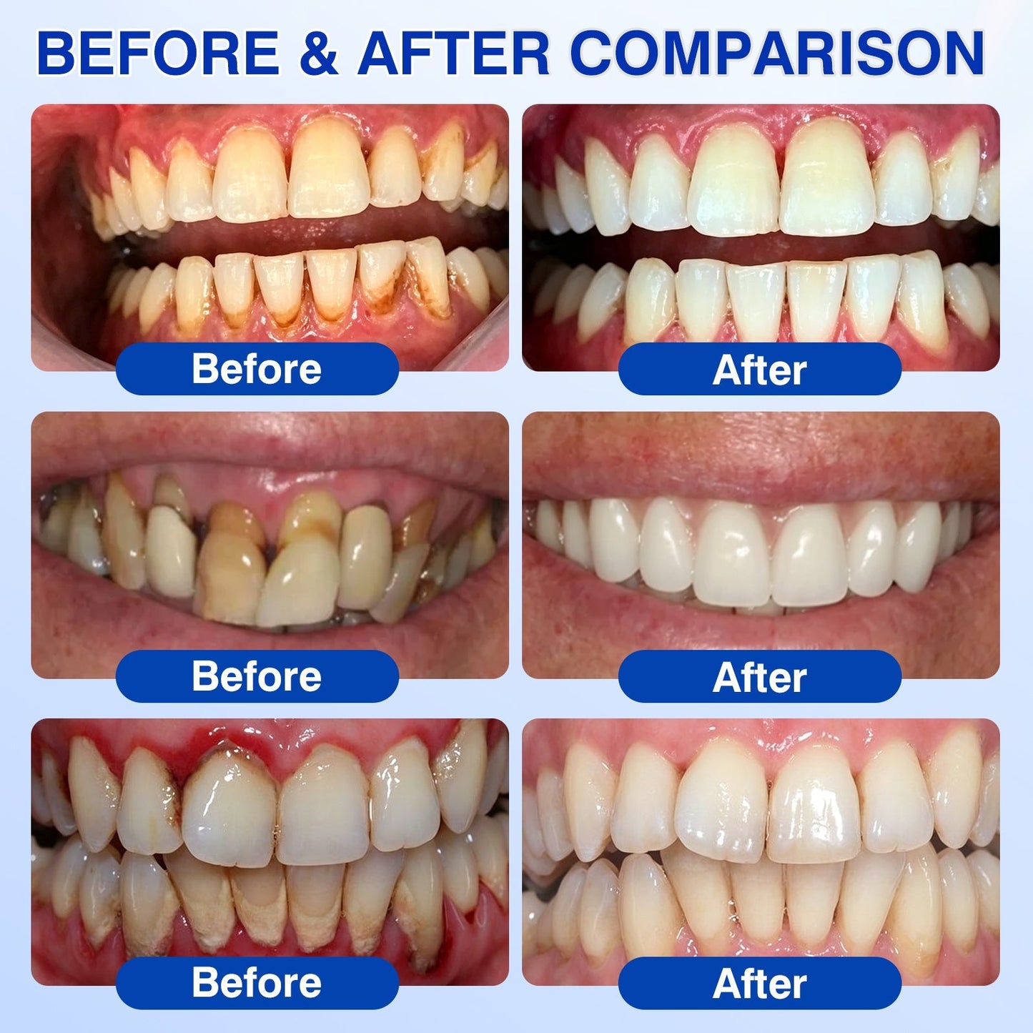 🦷Evolvion® GumRevive Periodontal Repair Gel