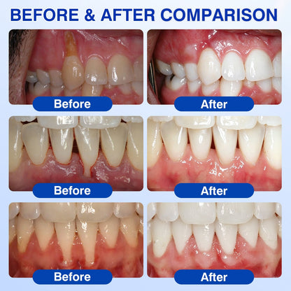 🦷Evolvion® GumRevive Periodontal Repair Gel