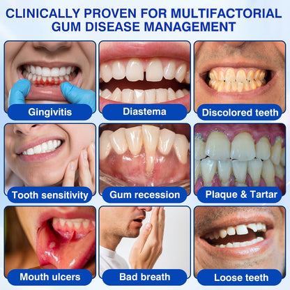 🦷Evolvion® GumRevive Periodontal Repair Gel