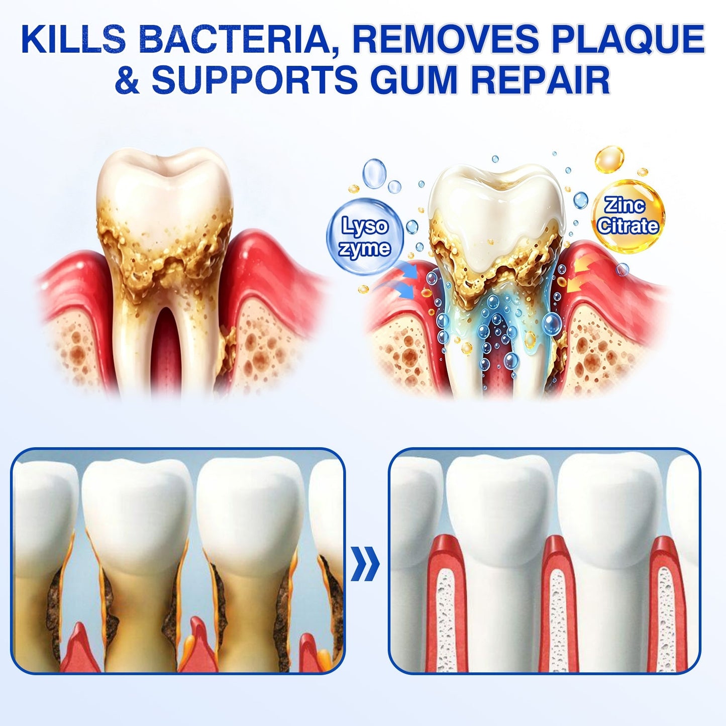 🦷Evolvion® GumRevive Periodontal Repair Gel