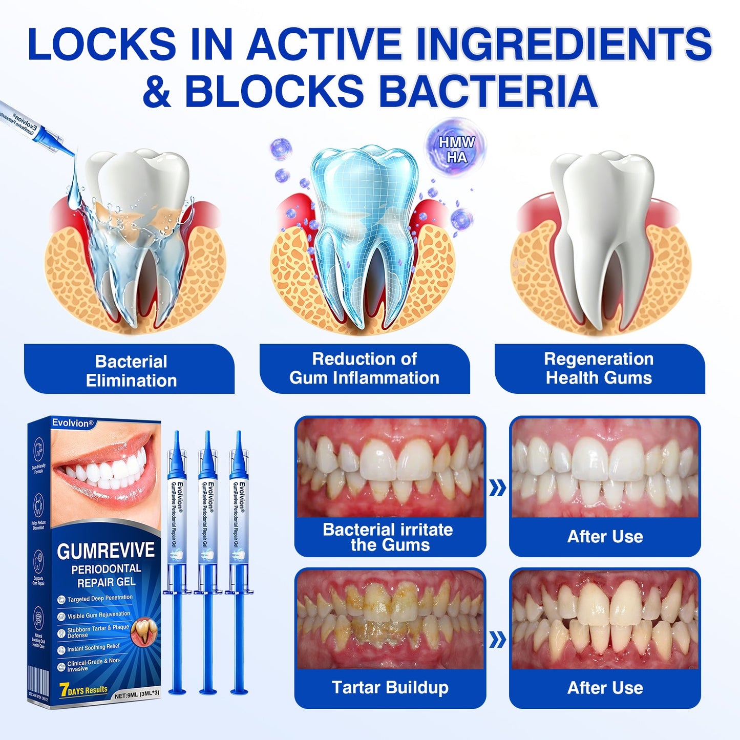 🦷Evolvion® GumRevive Periodontal Repair Gel