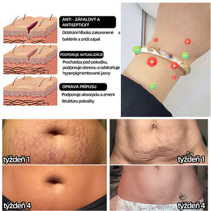 𝐂𝐙𝐓𝐈𝐂𝐋𝐄™Zlatý náramok s kláštornou emalou👩‍⚕️ Magnetická lymfatická terapia💥
