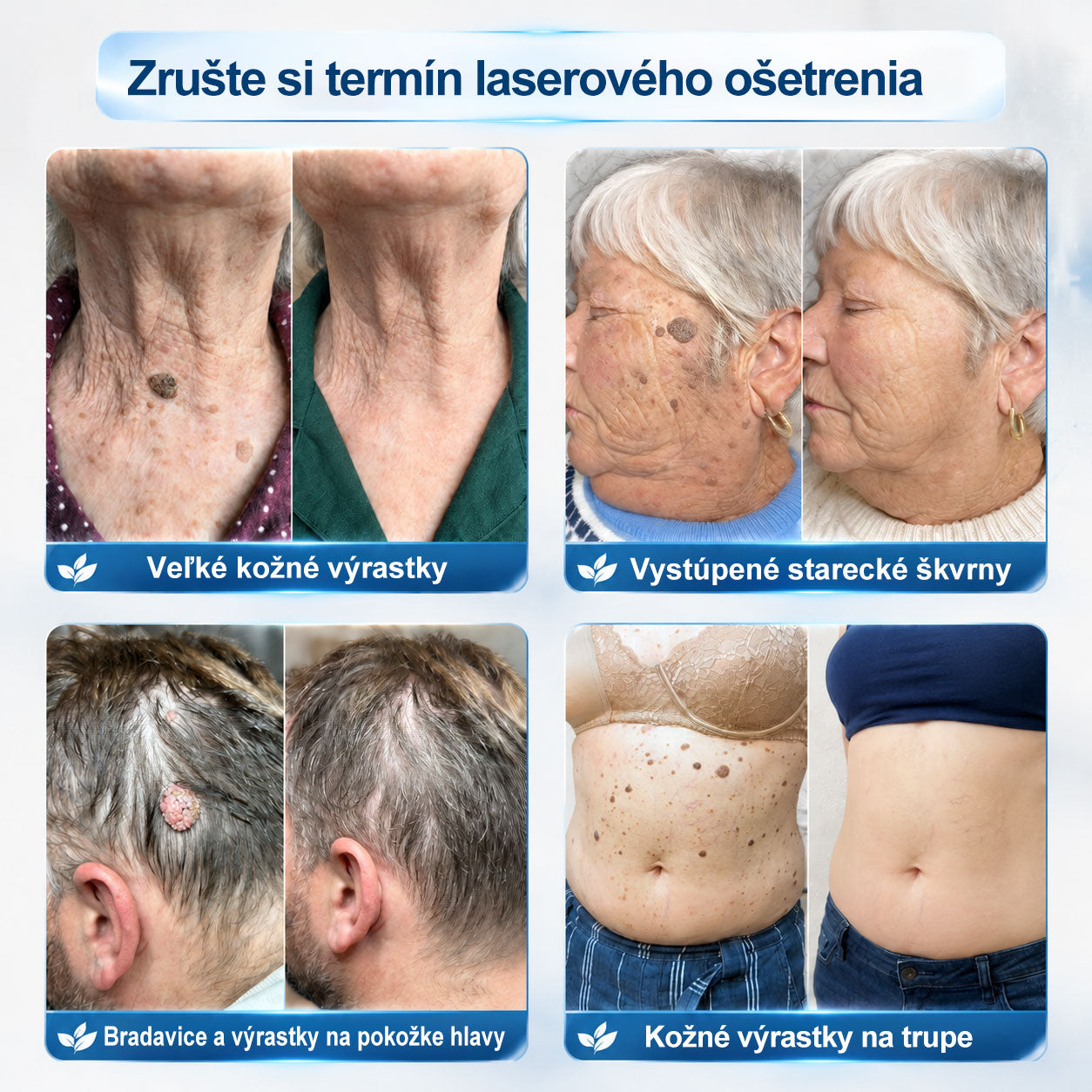 𝑶𝒇𝒊𝒄𝒊á𝒍𝒏𝒚 𝒐𝒃𝒄𝒉𝒐𝒅 ✅️ | 𝑷𝐢𝐜𝑑𝑜® 7-𝒅ň𝒐𝒗ý 𝒑𝒓í𝒑𝒓𝒂𝒗𝒐𝒌 𝒏𝒂 𝒐𝒅𝒔𝒕𝒓á𝒏𝒆𝒏𝒊𝒆 𝒌𝒐ž𝒏ý𝒄𝒉 𝒗ý𝒓𝒂𝒔𝒕𝒌𝒐𝒗 𝒂 𝒑𝒊𝒈𝒎𝒆𝒏𝒕𝒐𝒗ý𝒄𝒉 š𝒌𝒗ŕ𝒏👩‍⚕️ (𝒃𝒆𝒛 𝒃𝒐𝒍𝒆𝒔𝒕𝒊, 𝒃𝒆𝒛 𝒋𝒂𝒛𝒊𝒆𝒗, 𝒑𝒓𝒆𝒔𝒏ý 𝒓𝒐𝒍𝒍-𝒐𝒏 𝒂𝒑𝒍𝒊𝒌á𝒕𝒐𝒓) ❤️‍🔥