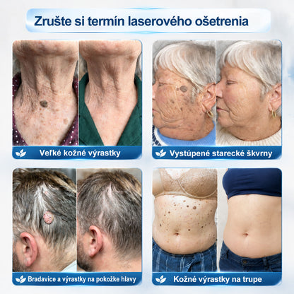 𝑶𝒇𝒊𝒄𝒊á𝒍𝒏𝒚 𝒐𝒃𝒄𝒉𝒐𝒅 ✅️ | 𝑷𝐢𝐜𝑑𝑜® 7-𝒅ň𝒐𝒗ý 𝒑𝒓í𝒑𝒓𝒂𝒗𝒐𝒌 𝒏𝒂 𝒐𝒅𝒔𝒕𝒓á𝒏𝒆𝒏𝒊𝒆 𝒌𝒐ž𝒏ý𝒄𝒉 𝒗ý𝒓𝒂𝒔𝒕𝒌𝒐𝒗 𝒂 𝒑𝒊𝒈𝒎𝒆𝒏𝒕𝒐𝒗ý𝒄𝒉 š𝒌𝒗ŕ𝒏👩‍⚕️ (𝒃𝒆𝒛 𝒃𝒐𝒍𝒆𝒔𝒕𝒊, 𝒃𝒆𝒛 𝒋𝒂𝒛𝒊𝒆𝒗, 𝒑𝒓𝒆𝒔𝒏ý 𝒓𝒐𝒍𝒍-𝒐𝒏 𝒂𝒑𝒍𝒊𝒌á𝒕𝒐𝒓) ❤️‍🔥