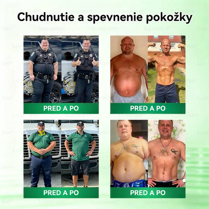 Oficiálny obchod  | 👩‍⚕️ 𝗟𝘂𝘅𝗮𝗿𝗶𝘀𝗲® Moringa X Berberín 10-In-1 Pokročilý Nano Mikroihla Nálepka(Raz denne, viditeľné zmeny za 7 dní) ✅ Obezita, cukrovka, spánková apnoe a problémy so kĺbmi🌟