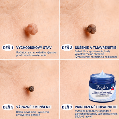 𝐏𝐢𝐜𝐝𝐨® 𝟕-𝐝𝐧̌𝐨𝐯ý 𝐤𝐫é𝐦 𝐩𝐫𝐞 𝐯𝐢𝐬𝐧𝐮𝐭ú 𝐩𝐨𝐤𝐨ž𝐤𝐮 𝐚 𝐩𝐢𝐠𝐦𝐞𝐧𝐭𝐨𝐯é 𝐟𝐥𝐞𝐤𝐲 (𝐛𝐞𝐳𝐛𝐨𝐥𝐞𝐬𝐭𝐧á 𝐟𝐨𝐫𝐦𝐮𝐥𝐚 – 𝐛𝐞𝐳 𝐣𝐚𝐳𝐯𝐢𝐞𝐯) 🍁