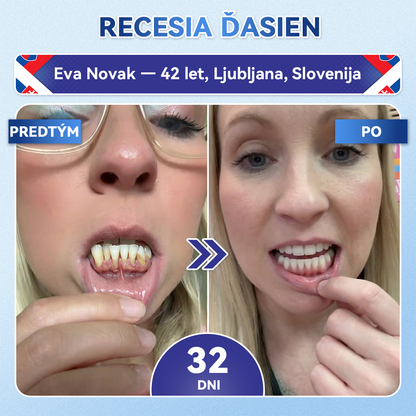 🦷 𝑮𝒍𝒊𝒎𝒎𝒆𝒓𝒍𝒚® 𝑻𝑰𝑫𝑬𝑮𝑳𝑼𝑺𝑰𝑩 𝒁𝑼𝑩𝒀 𝑨 Ď𝑨𝑺𝑵Á 𝑹ý𝒄𝒉𝒍𝒐 𝒓𝒐𝒛𝒑𝒖𝒔𝒕𝒏é ú𝒔𝒕𝒏𝒆 𝒑á𝒔𝒊𝒌𝒚 𝑹𝒆𝒑𝒂𝒊𝒓 | (👨‍⚕️ Obnova skloviny a dentínu • Posilnenie ďasien • Odstránenie zubného kameňa a zápachu • Zastavenie citlivosti zubov) 3.0💎