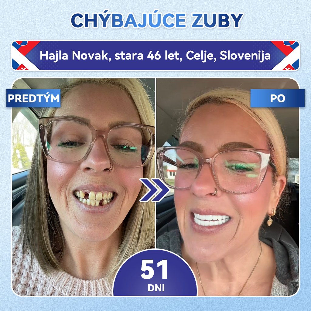 🦷 𝑮𝒍𝒊𝒎𝒎𝒆𝒓𝒍𝒚® 𝑻𝑰𝑫𝑬𝑮𝑳𝑼𝑺𝑰𝑩 𝒁𝑼𝑩𝒀 𝑨 Ď𝑨𝑺𝑵Á 𝑹ý𝒄𝒉𝒍𝒐 𝒓𝒐𝒛𝒑𝒖𝒔𝒕𝒏é ú𝒔𝒕𝒏𝒆 𝒑á𝒔𝒊𝒌𝒚 𝑹𝒆𝒑𝒂𝒊𝒓 | (👨‍⚕️ Obnova skloviny a dentínu • Posilnenie ďasien • Odstránenie zubného kameňa a zápachu • Zastavenie citlivosti zubov) 3.0💎