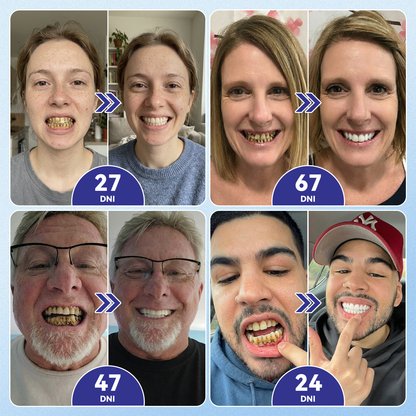 🦷 𝑮𝒍𝒊𝒎𝒎𝒆𝒓𝒍𝒚® 𝑻𝑰𝑫𝑬𝑮𝑳𝑼𝑺𝑰𝑩 𝒁𝑼𝑩𝒀 𝑨 Ď𝑨𝑺𝑵Á 𝑹ý𝒄𝒉𝒍𝒐 𝒓𝒐𝒛𝒑𝒖𝒔𝒕𝒏é ú𝒔𝒕𝒏𝒆 𝒑á𝒔𝒊𝒌𝒚 𝑹𝒆𝒑𝒂𝒊𝒓 | (👨‍⚕️ Obnova skloviny a dentínu • Posilnenie ďasien • Odstránenie zubného kameňa a zápachu • Zastavenie citlivosti zubov) 3.0💎