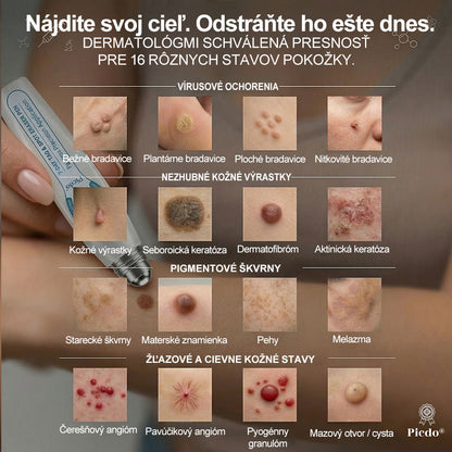 𝑶𝒇𝒊𝒄𝒊á𝒍𝒏𝒚 𝒐𝒃𝒄𝒉𝒐𝒅 ✅️ | 𝑷𝐢𝐜𝑑𝑜® 7-𝒅ň𝒐𝒗ý 𝒑𝒓í𝒑𝒓𝒂𝒗𝒐𝒌 𝒏𝒂 𝒐𝒅𝒔𝒕𝒓á𝒏𝒆𝒏𝒊𝒆 𝒌𝒐ž𝒏ý𝒄𝒉 𝒗ý𝒓𝒂𝒔𝒕𝒌𝒐𝒗 𝒂 𝒑𝒊𝒈𝒎𝒆𝒏𝒕𝒐𝒗ý𝒄𝒉 š𝒌𝒗ŕ𝒏👩‍⚕️ (𝒃𝒆𝒛 𝒃𝒐𝒍𝒆𝒔𝒕𝒊, 𝒃𝒆𝒛 𝒋𝒂𝒛𝒊𝒆𝒗, 𝒑𝒓𝒆𝒔𝒏ý 𝒓𝒐𝒍𝒍-𝒐𝒏 𝒂𝒑𝒍𝒊𝒌á𝒕𝒐𝒓) ❤️‍🔥