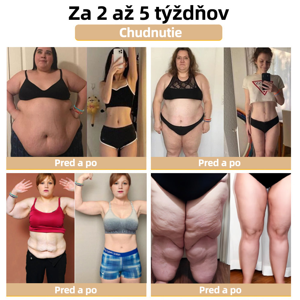 𝐂𝐙𝐓𝐈𝐂𝐋𝐄™Zlatý náramok s kláštornou emalou👩‍⚕️ Magnetická lymfatická terapia💥
