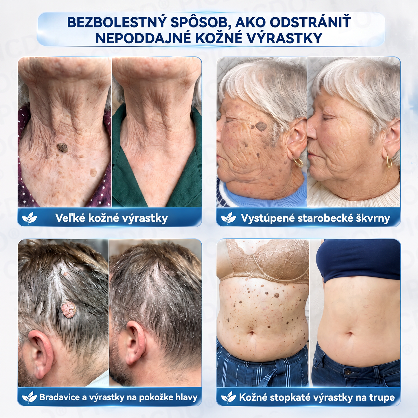 𝐏𝐢𝐜𝐝𝐨® 𝟕-𝐝𝐧̌𝐨𝐯ý 𝐤𝐫é𝐦 𝐩𝐫𝐞 𝐯𝐢𝐬𝐧𝐮𝐭ú 𝐩𝐨𝐤𝐨ž𝐤𝐮 𝐚 𝐩𝐢𝐠𝐦𝐞𝐧𝐭𝐨𝐯é 𝐟𝐥𝐞𝐤𝐲 (𝐛𝐞𝐳𝐛𝐨𝐥𝐞𝐬𝐭𝐧á 𝐟𝐨𝐫𝐦𝐮𝐥𝐚 – 𝐛𝐞𝐳 𝐣𝐚𝐳𝐯𝐢𝐞𝐯) 🍁